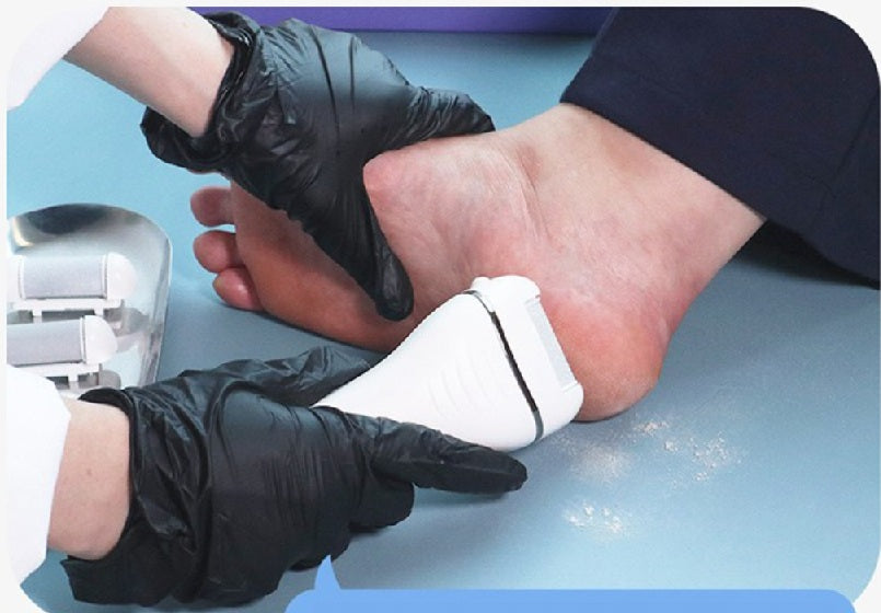 Face Factory Electric Foot Callus Remover, UV Rechargeable Exfoliator